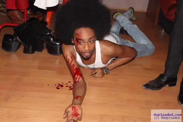 Graphic Photos: Denrele Falls & Injures While Shooting The Movie “Pepper Soup”